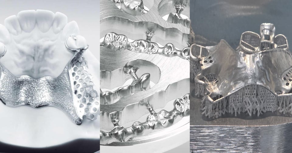 1200 x 628 Dental prosthetics