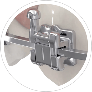 Discovert smaart sl 600 x 600