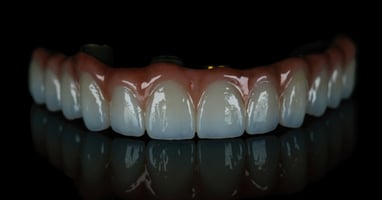 Aesthetic dentistry: A ceraMotion Z Case Example