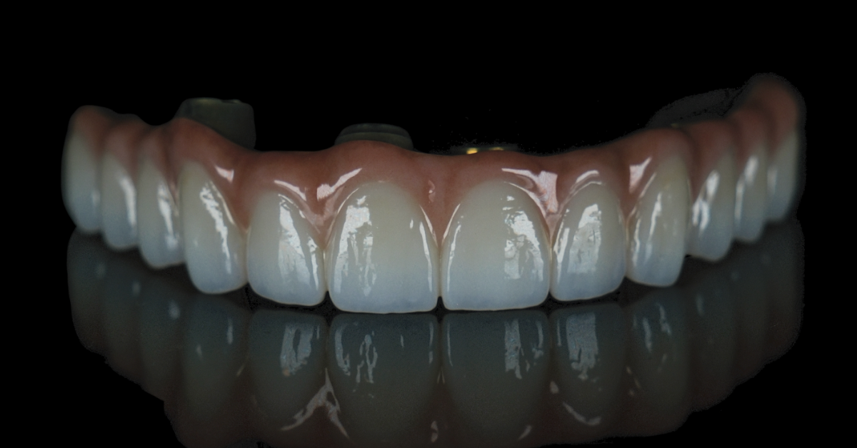 Aesthetic Dentistry: A ceraMotion® Z Case example