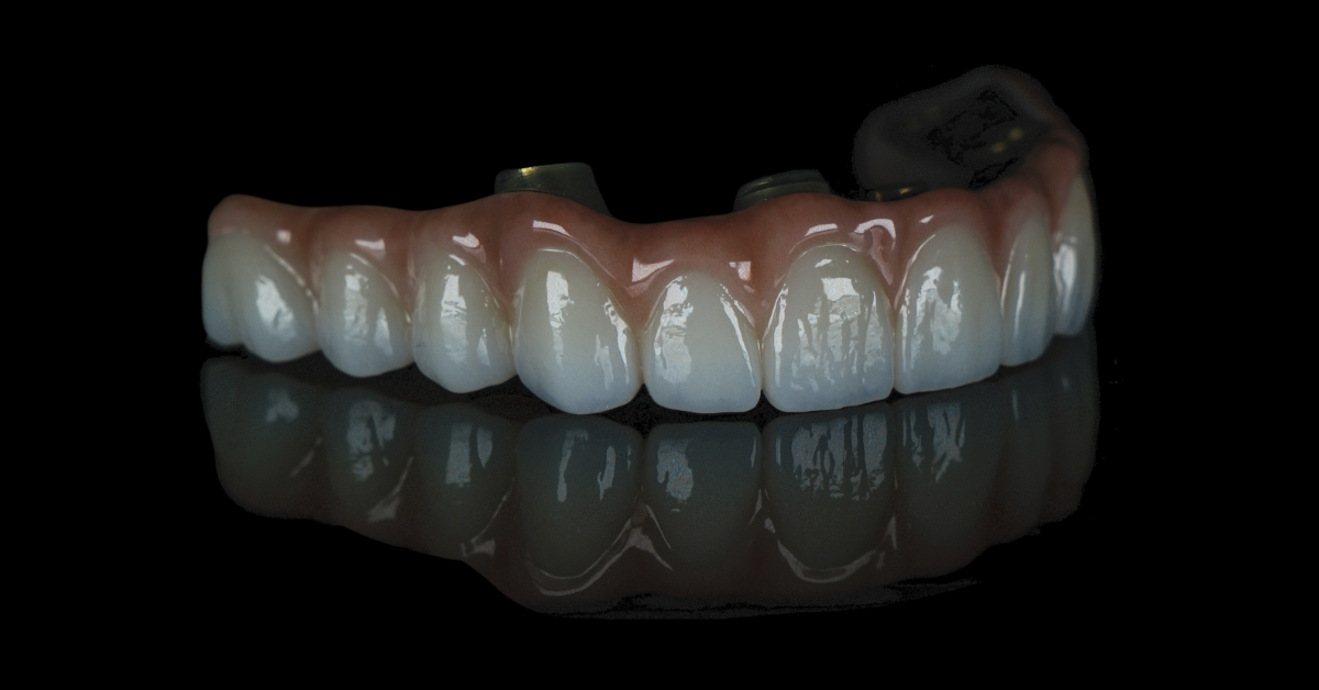 Aesthetic dentistry. A brilliant result.