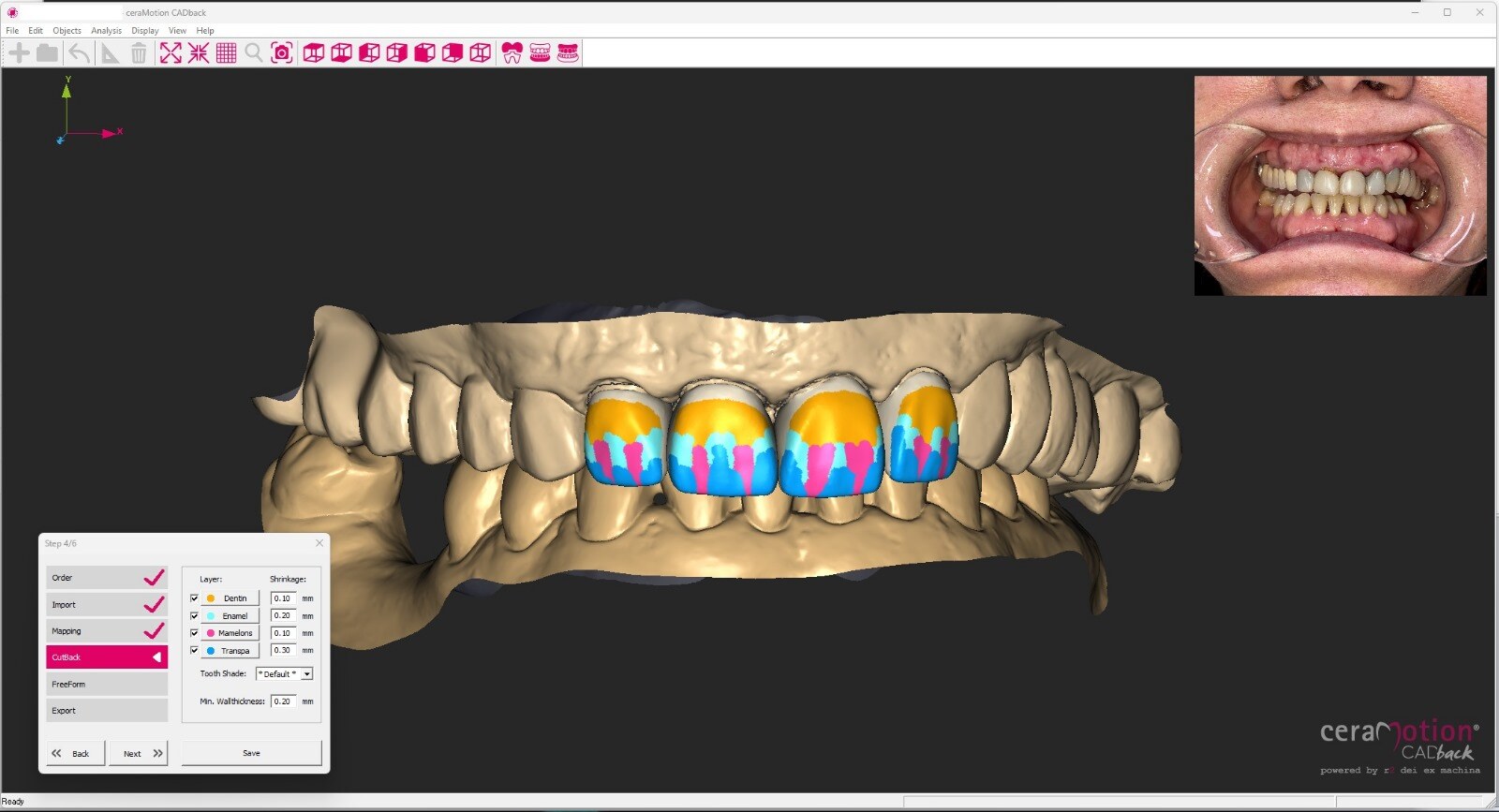 D cutback design mapping in CADback