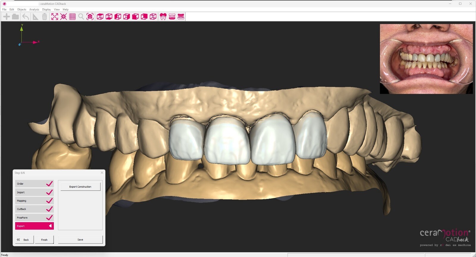 Final cutback in CADback software