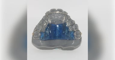 Wong Active Retainer A Point Dental Lab