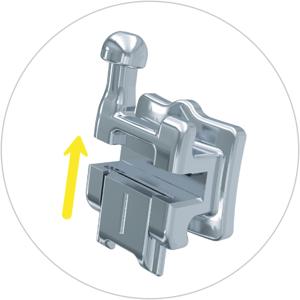 discovery smart sl bracket 