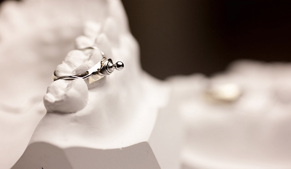 orthodontic brackets