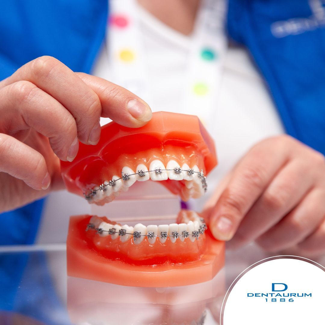 Better brackets with Dentaurum